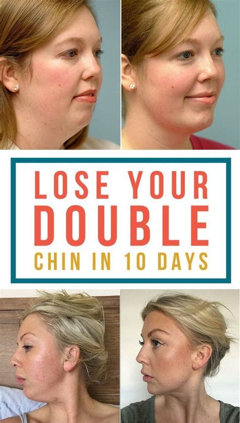 how to get rid of doublr chin